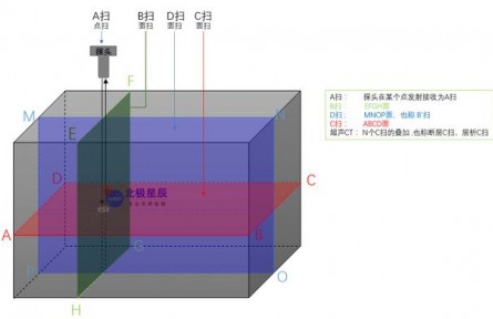 什么是A扫描、B扫描、C扫描、D扫描